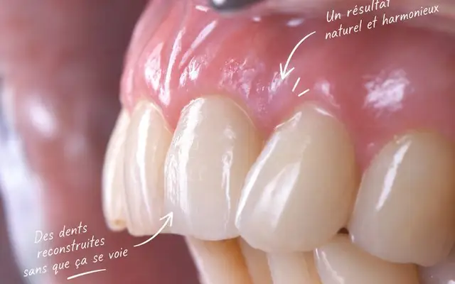 Esthétique du sourire