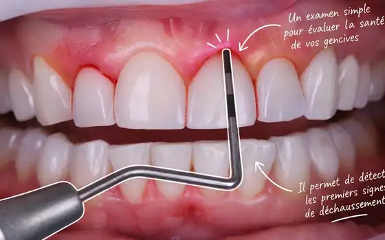 Parodontologie : soin des gencives